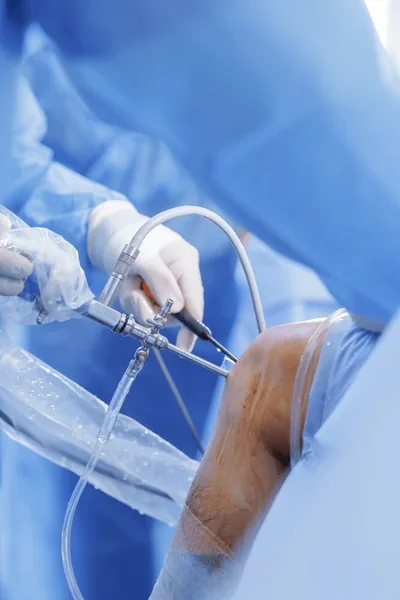 Procedimiento de artroscopia de rodilla — técnica mínimamente invasiva con artroscopio